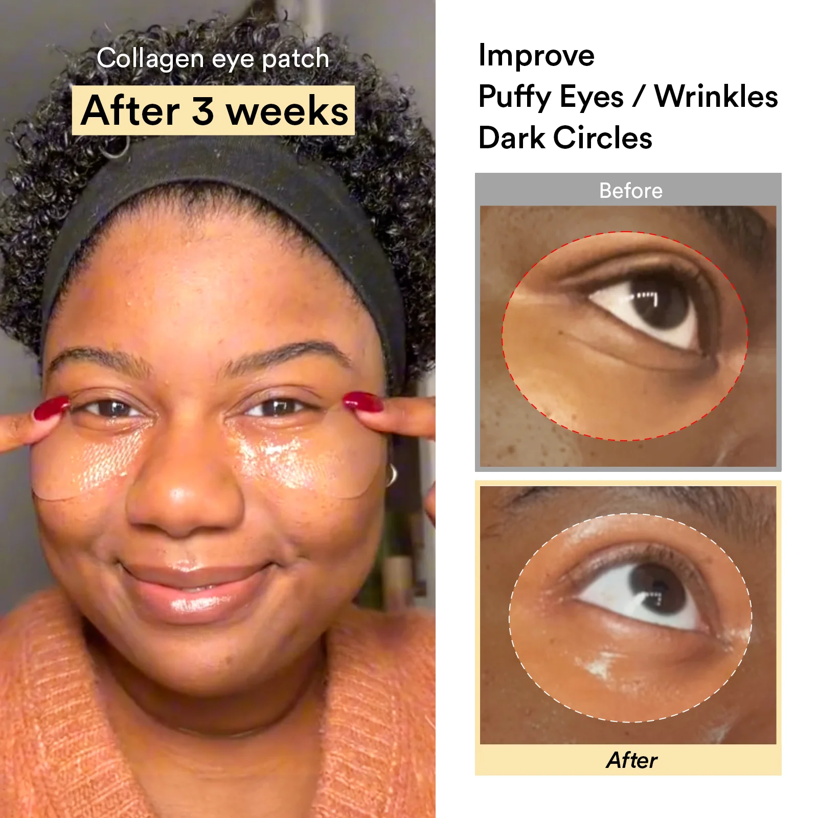 Eye-Deal Collagen Eye Care Kit - Image 9