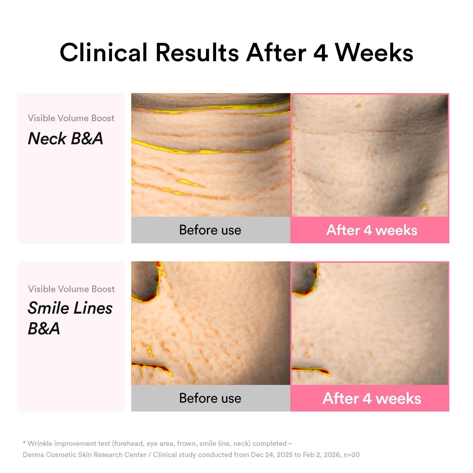 Eye Volume Duo - Image 6